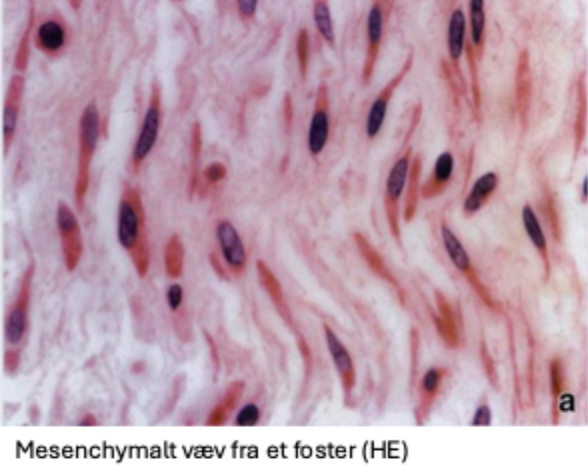 <p>Celler: små, tenformet, forbundne i 3D netværk via gap junctions</p><p>ECM: viskøst, sparsomme, fine kollagne og retikulære fibre</p>