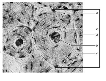 <p>d</p><p>Bone cell</p>