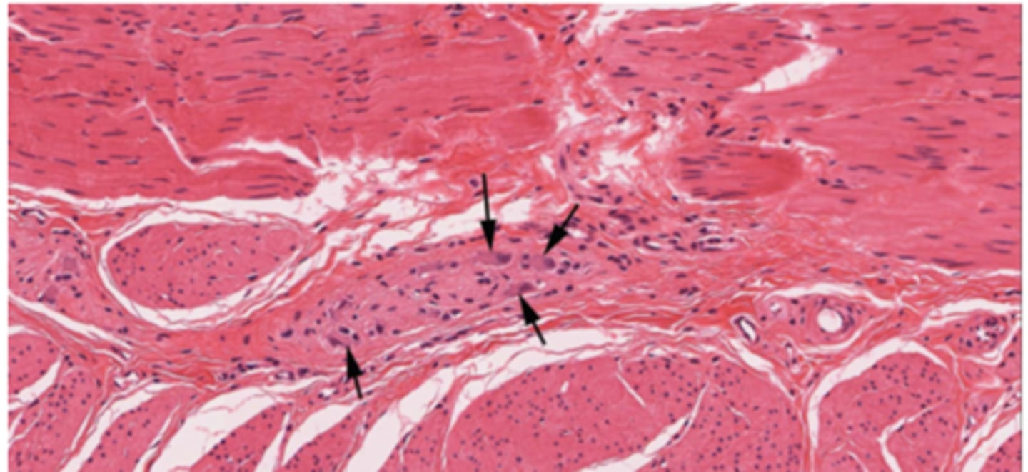 <p>Identify the organ of the PNS</p>