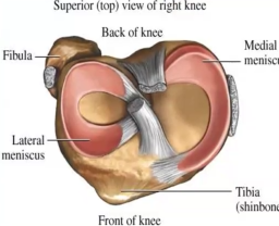 <p>Which <strong>ligament </strong>is the <strong>medial </strong>meniscus firmly attached to?</p>