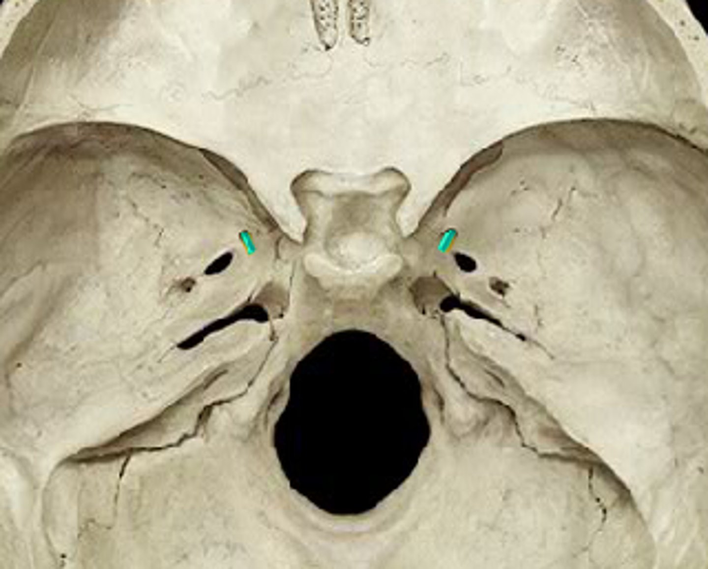 <p>First part of Cowboy Ros, transmits maxillary branch CN V2 (part of trigem)</p>