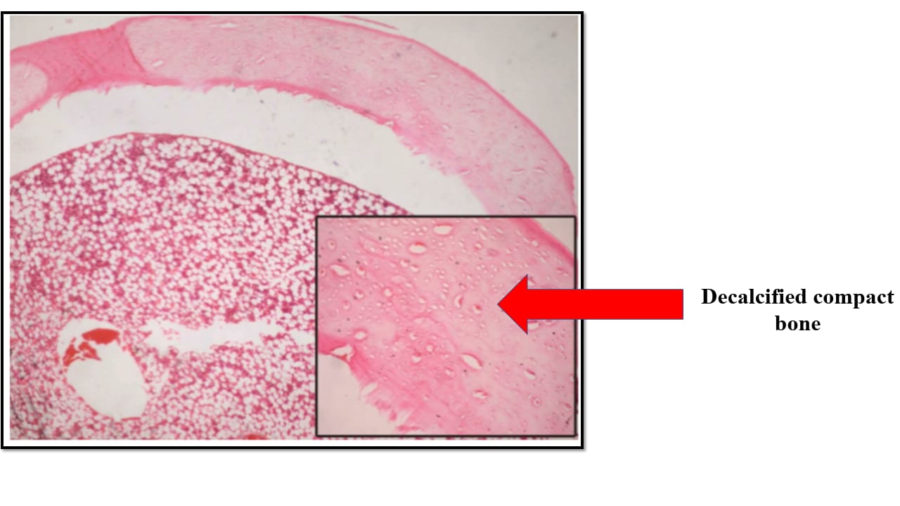 <p>Decalcified compact bone – LM</p>