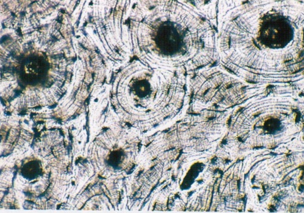 <p>Cells- osteoblasts, osteocyte <br>Matrix- gel like ground substance calcified with inorganic salts<br>Fibers- collagen <br>Function- support</p>