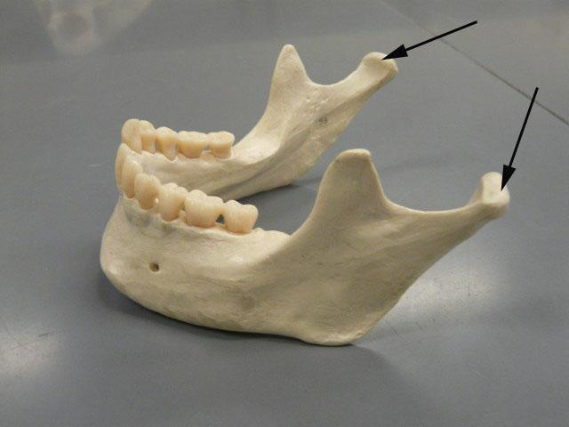 <p>Where the jaw attaches to the skull (Part of Mandible)</p>