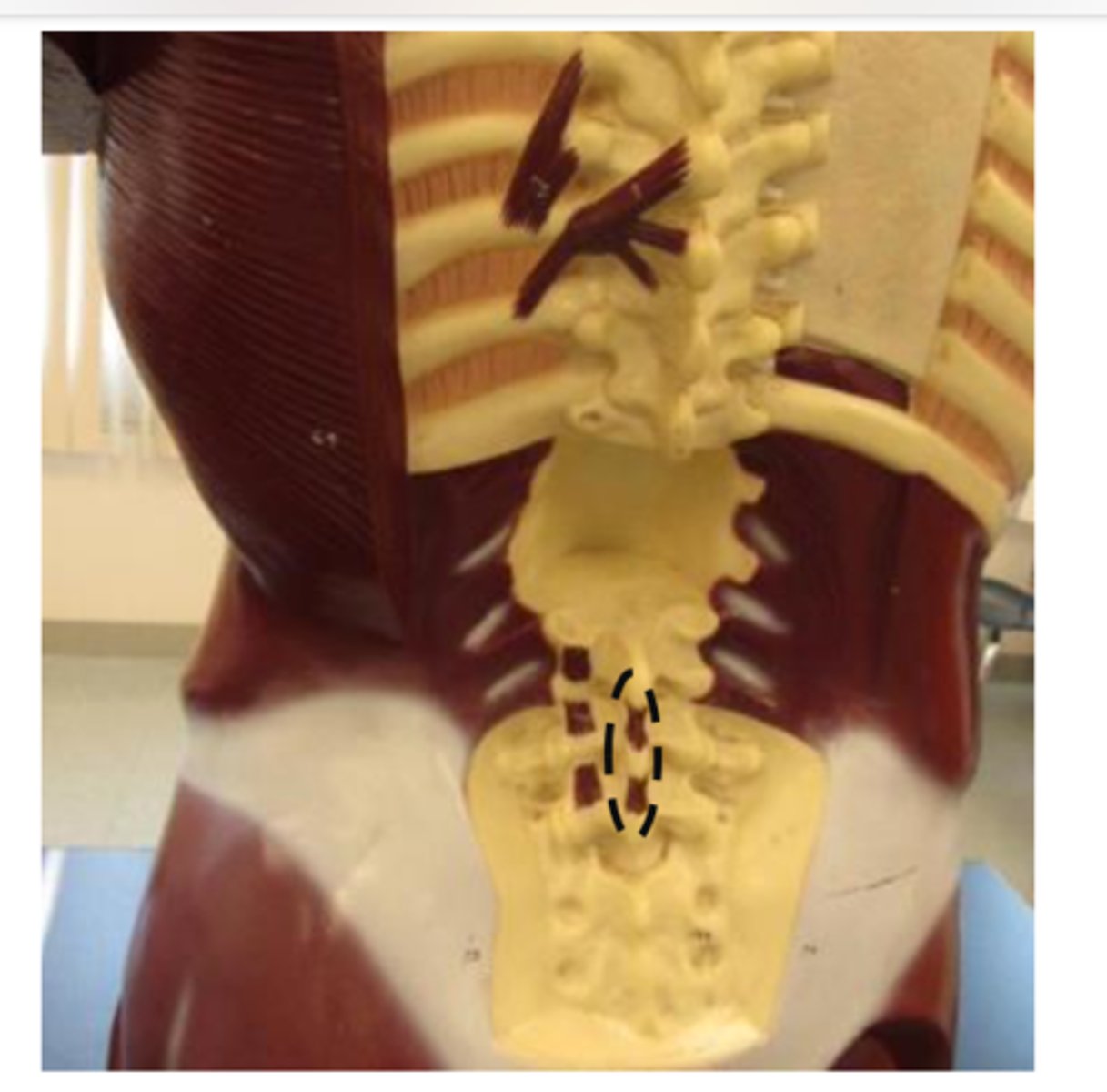 <p>model near sink (found along the spinous process all vertebrates of the vertebral column)</p>