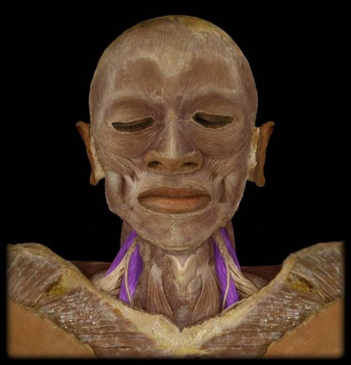 <p>what is the origin and insertion of the anterior scalene?</p>