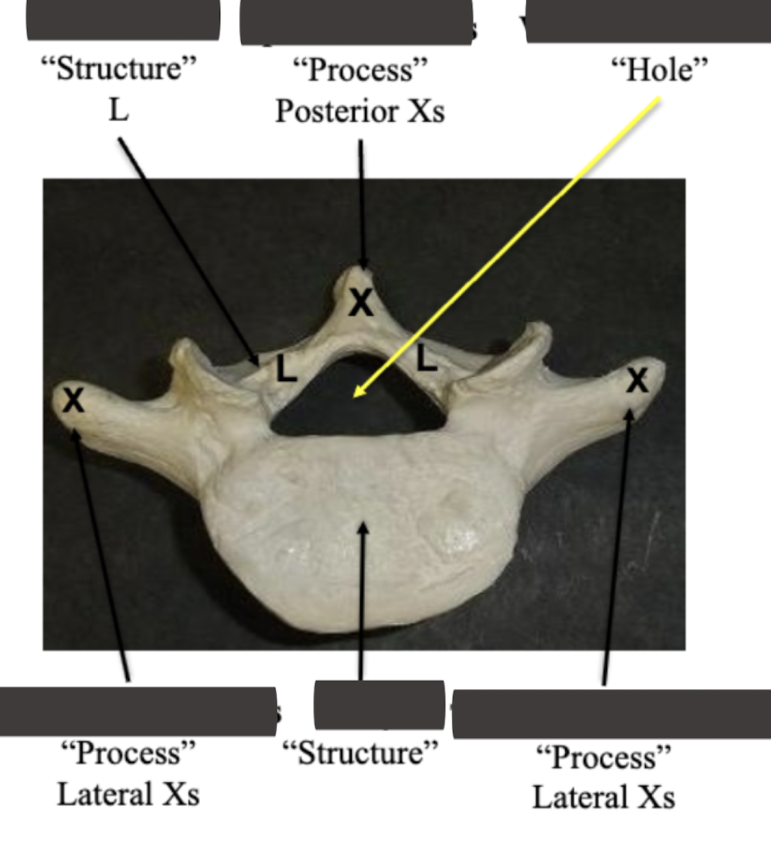 <p>Label the <strong>top process </strong></p>