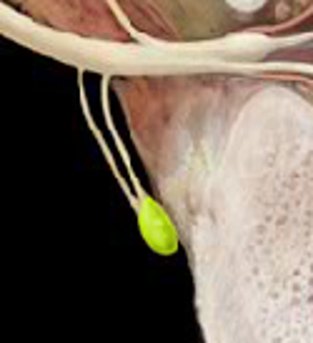 <p>Ganglion (bundle of nerve cell bodies) that receives preganglionic sympathetic fibers. part of sympathetic nervous system that has fight or flight response</p>