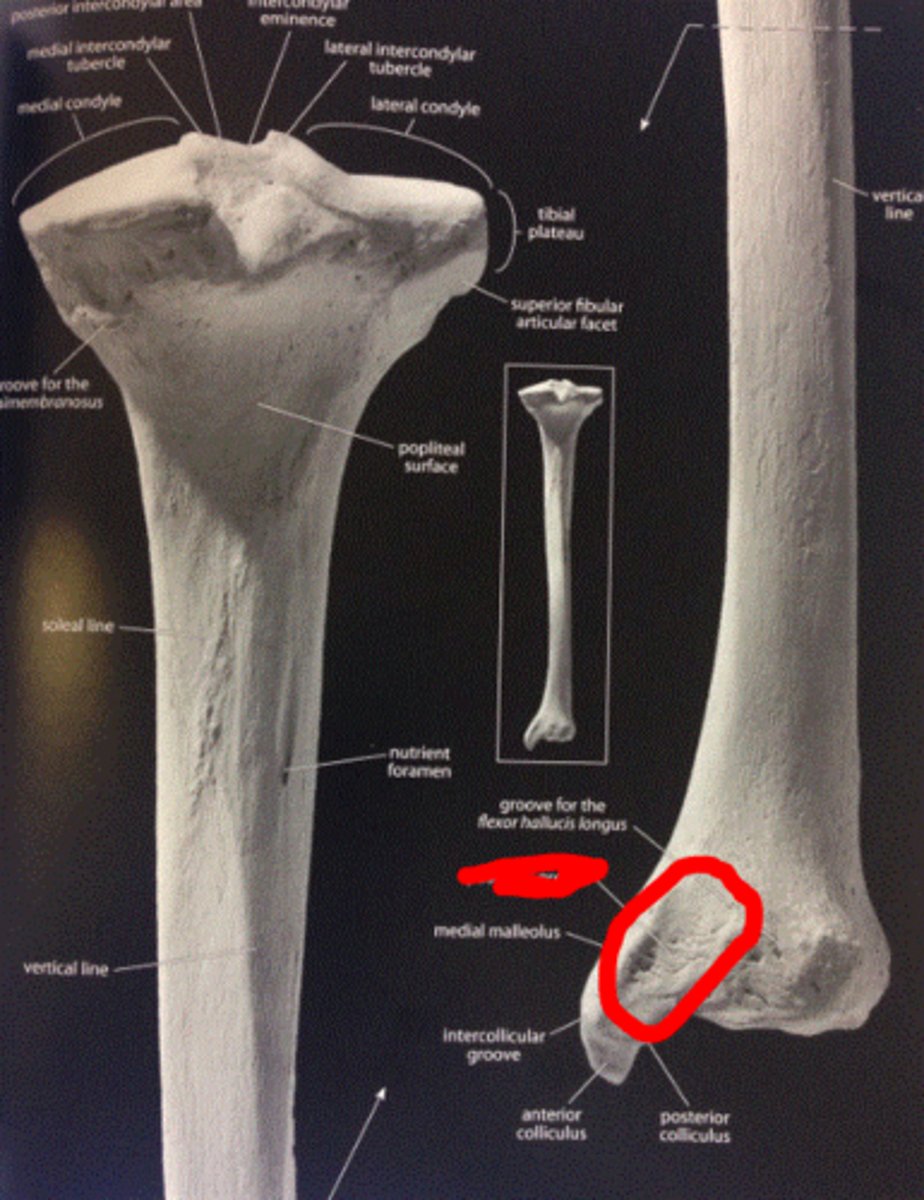 <p>posterior aspect of the MEDIAL MALLEOLUS</p>