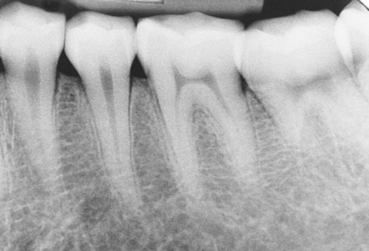 <p>- Intra-oral techniques designed to show individual teeth and the tissues around the apices.</p>