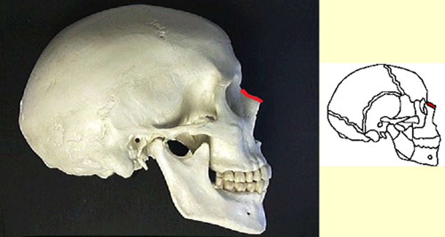 knowt flashcard image