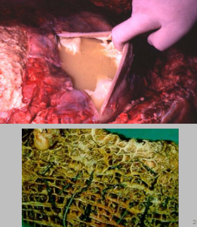 <p>Diagnose this. What are the clinical signs (5), pathogenesis and diagnostic tests (3)</p>