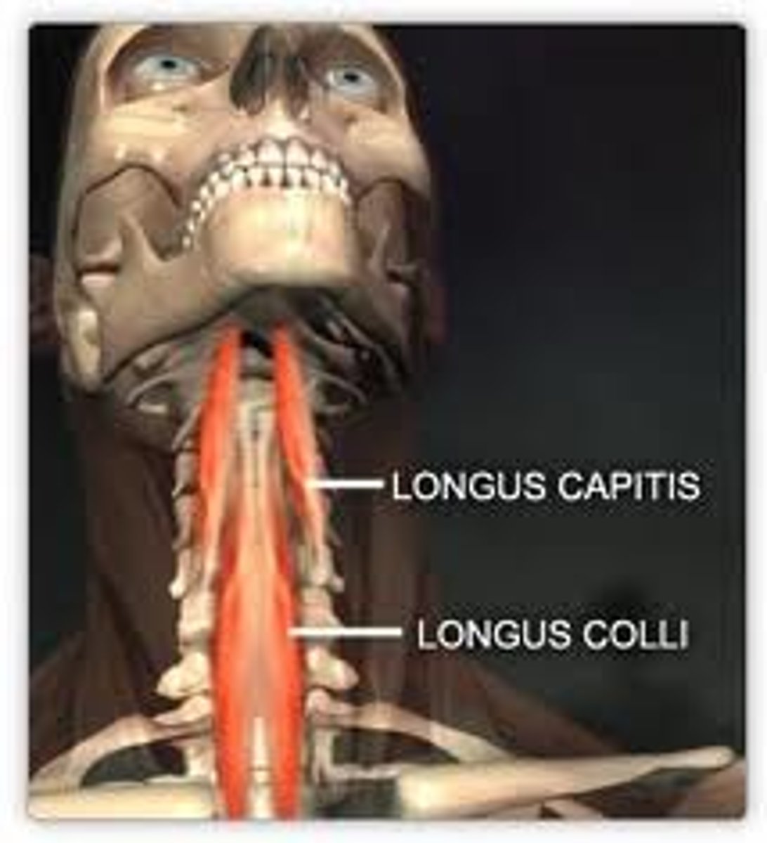 <p><span style="color: #e12a2a">- originate on transverse processes c4-c6, insert at base of occiput (capitis)</span></p><p><span style="color: #e12a2a">- originate at transverse process of cervical vertebrae (colli)</span></p><p><span style="color: #e12a2a">- flexion of cervical region</span></p><p><span style="color: #e12a2a">- same-side rotation</span></p>