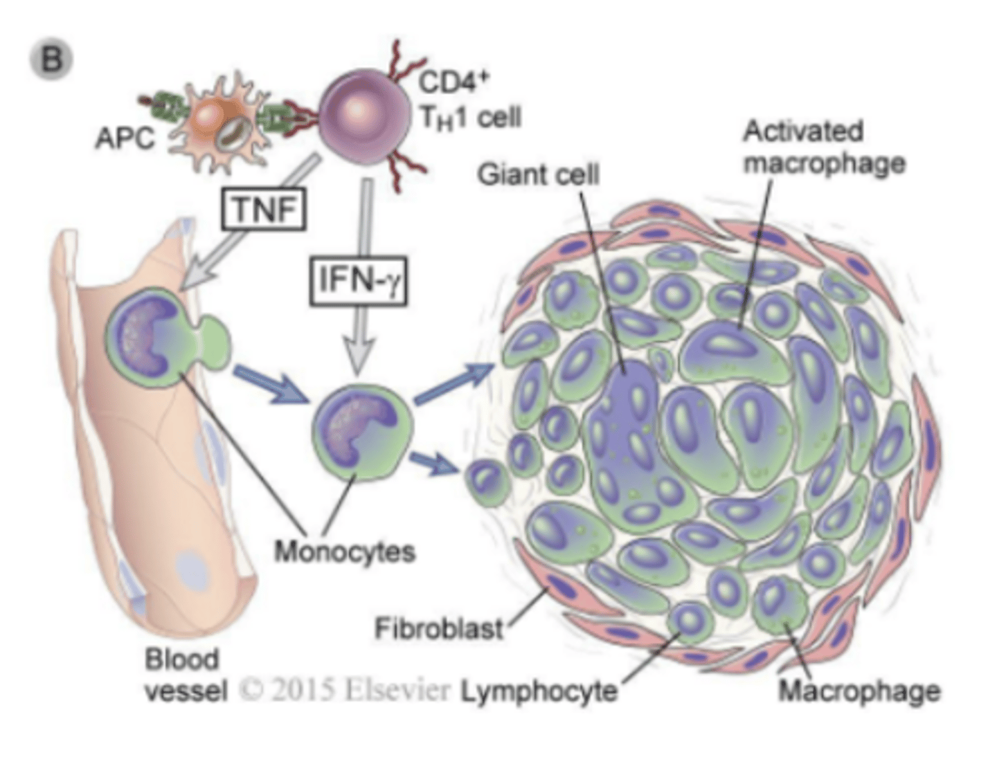 <p>granuloma formation</p>