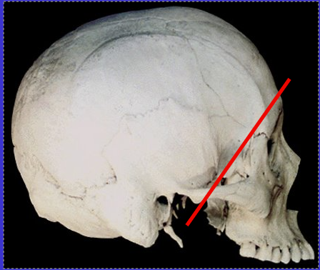 <p>What is the anterior region of the cranium called?</p>