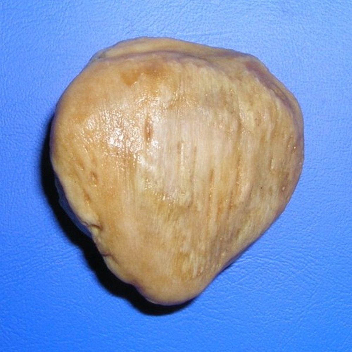 <p>kneecap</p>