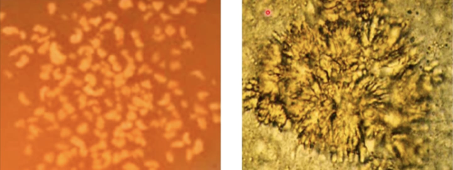 <p>- club shaped colonies with bacterial-sized filaments</p>