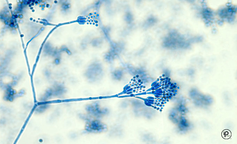 <p>Hyaline/Septate</p><p>Blue-green/white</p><p>Short phialides on metula, round conidia in chains, “brush-like”</p><p>Cutaneous, respiratory, external ear infections </p>