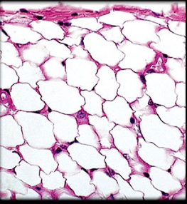 <p>Label the Adipose CT</p>