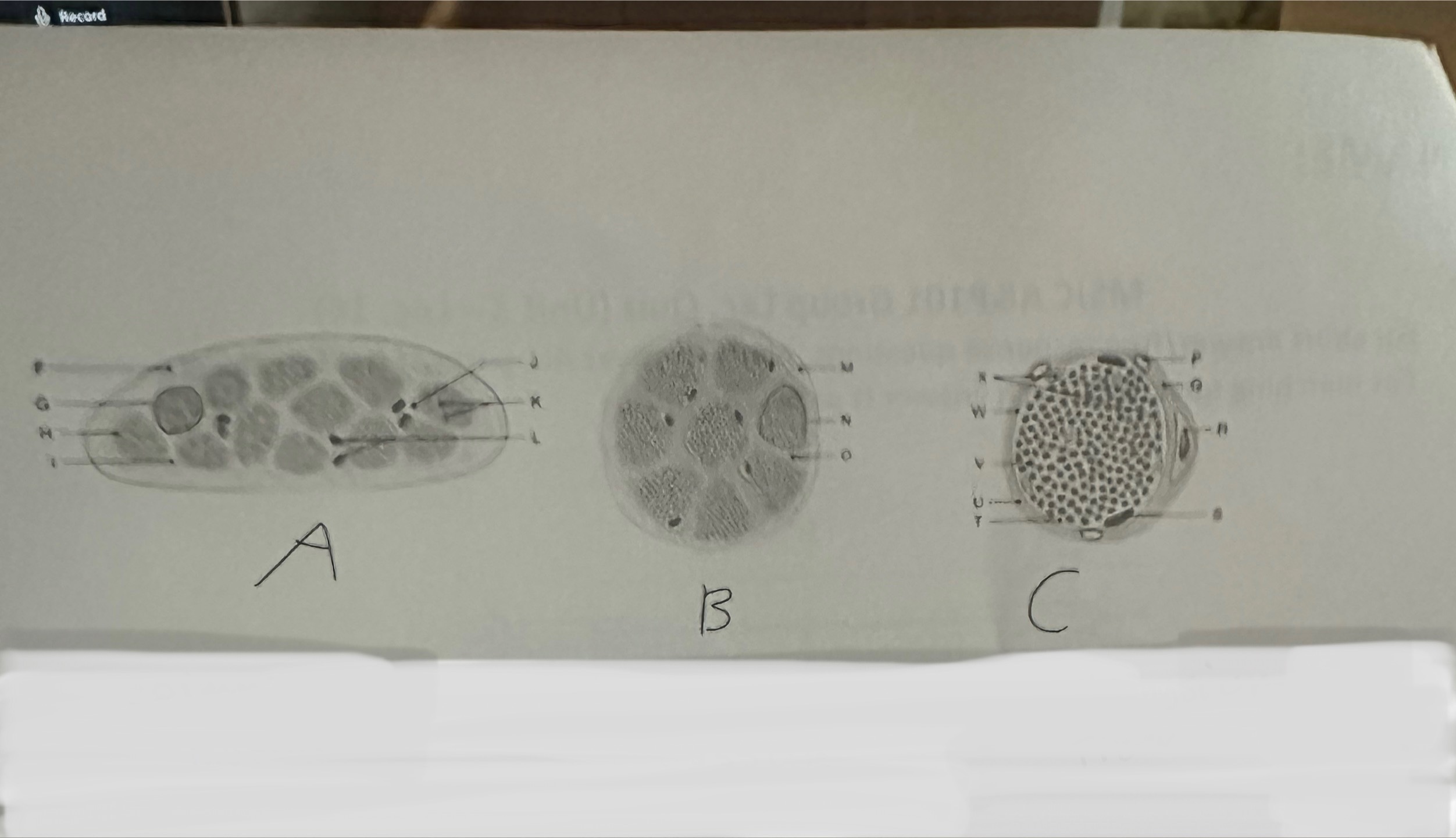 <p>Please name the Gross Anatomy sections for A, B, and, C</p>