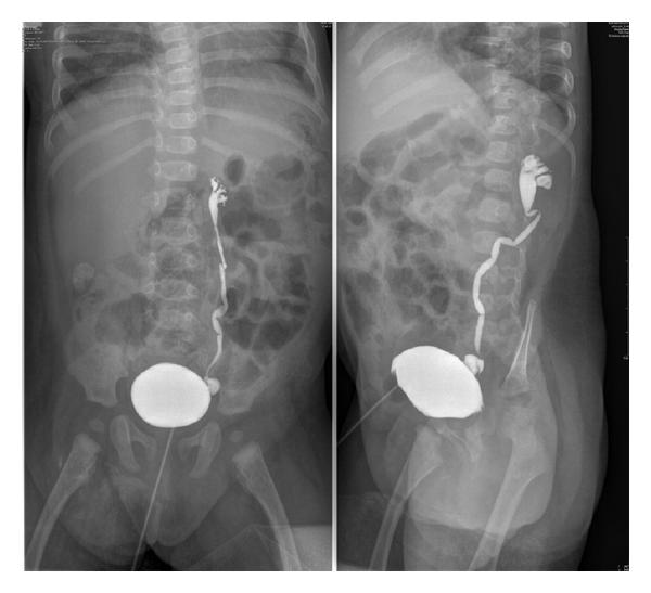 <p>voiding cystourethrogram</p>