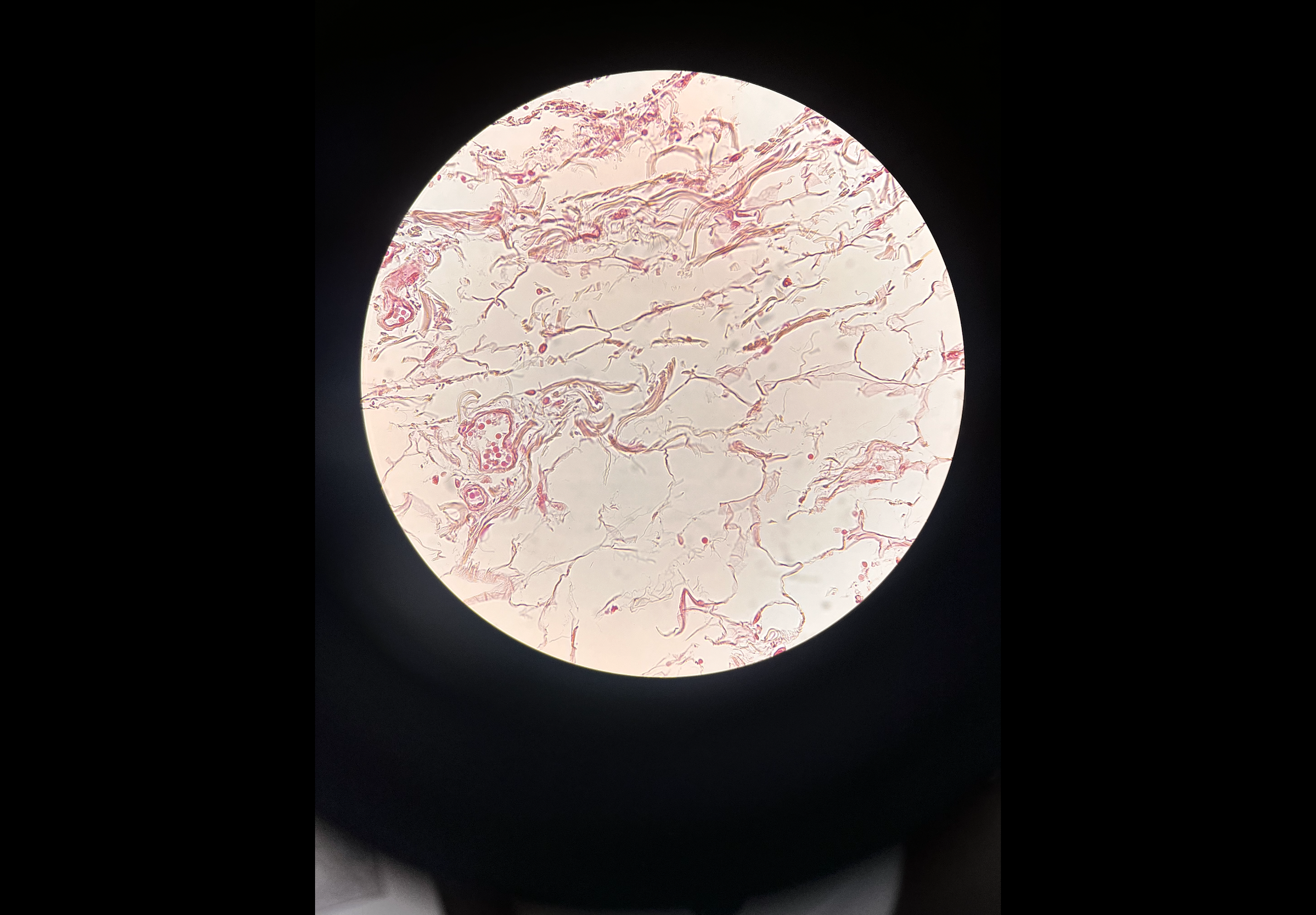 <p>Body location: hypodermis</p>