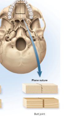 <p>Plane sutures (butt sutures)</p>