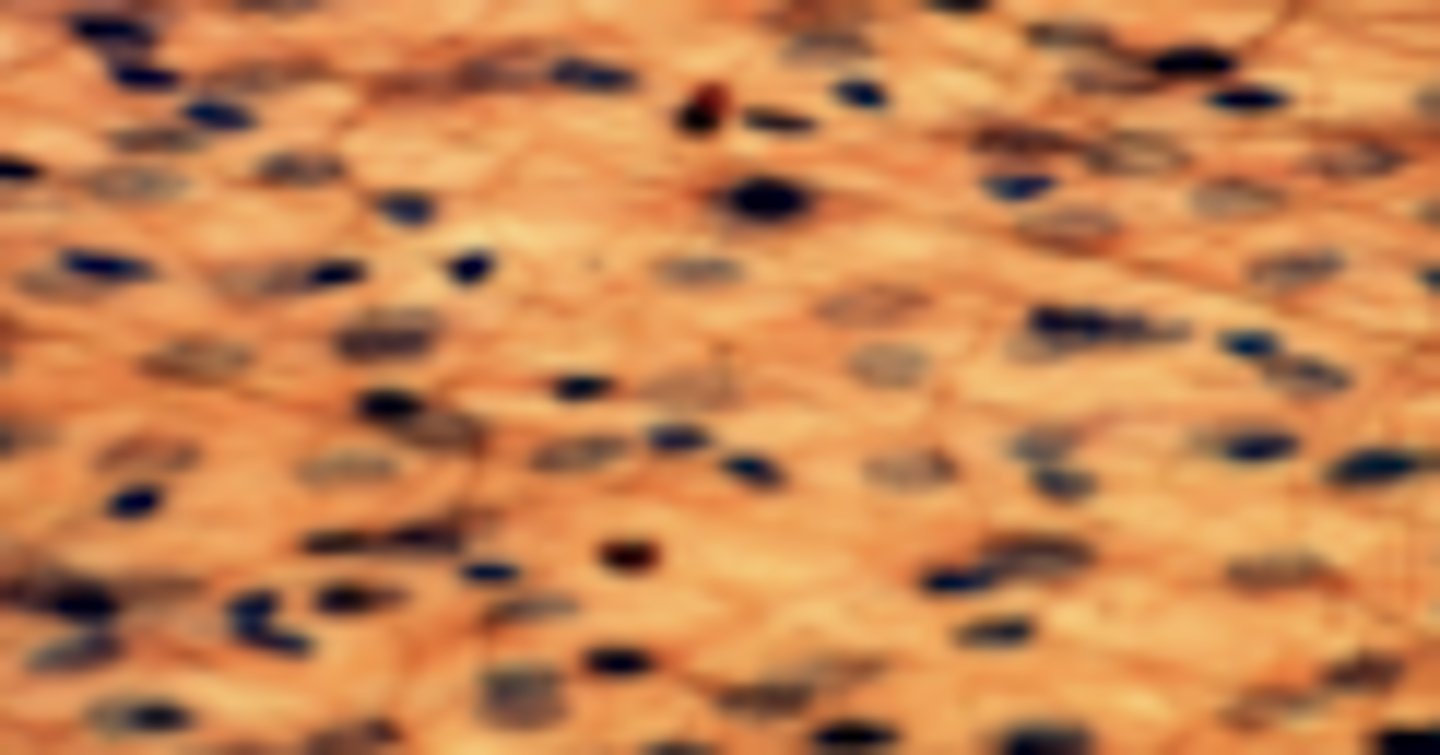 <p>What tissue type is shown?</p>