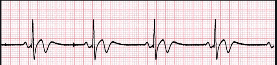 <p>ECG interpretation</p>