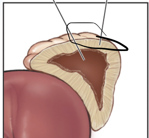 <p>+Adrenal cortex</p>