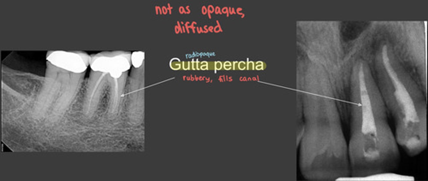 <p>gutta percha fills root canal</p><p>-not as opaque as silver points, diffused</p>
