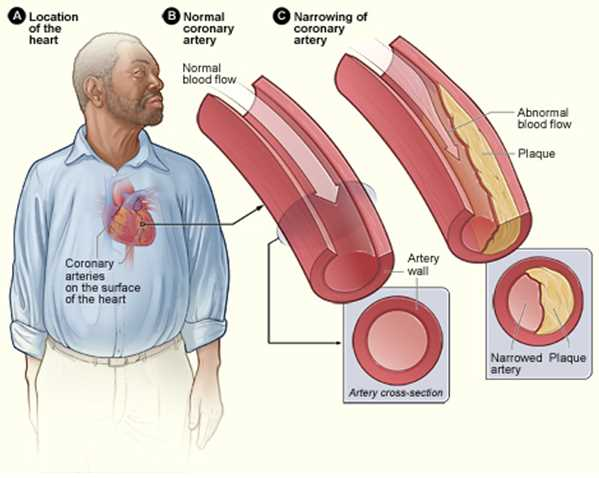 <p>The sum of the resistance encountered throughout the circulation</p><p>For the blood to overcome the resistance and keep flowing forwards, a pressure gradient is required</p><p>Controlled by <span>blood vessels and SNS&nbsp;</span></p>