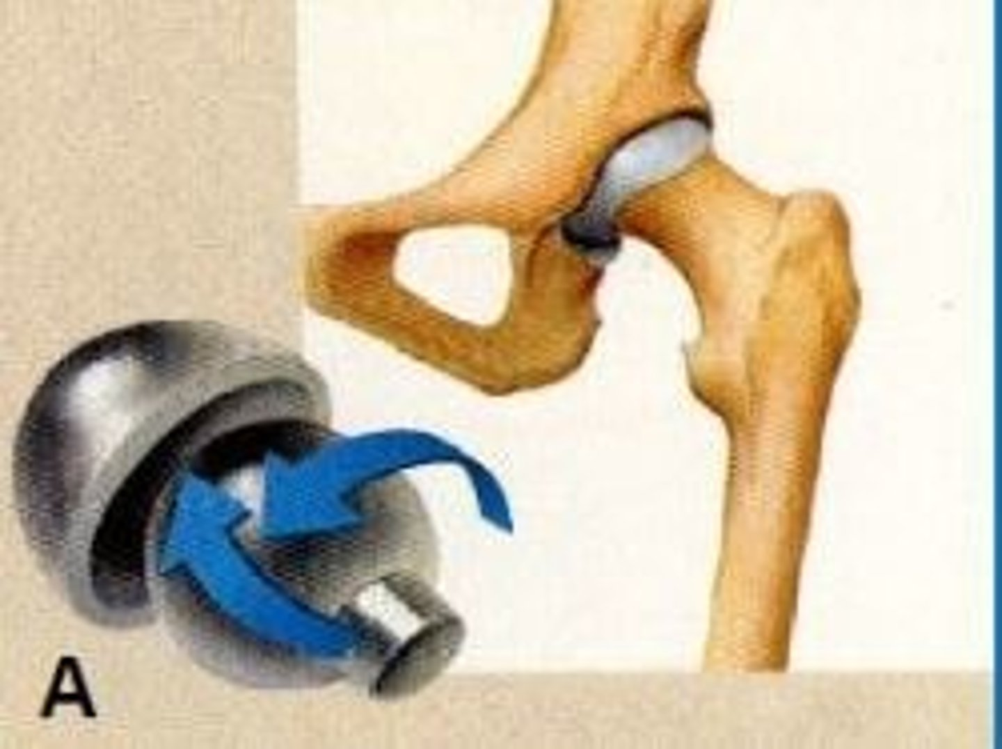 <p>How do you classify the synovial joint shown in image A?</p>