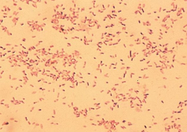 <p><mark data-color="yellow">Gram variable rods</mark></p><p><mark data-color="yellow">col: beta-hem on V agar (human blood) &amp; non-hem on SBA</mark></p><p></p><p>oxidase = neg</p><p>catalase = neg</p><p>hippurate hydrolysis = pos</p>