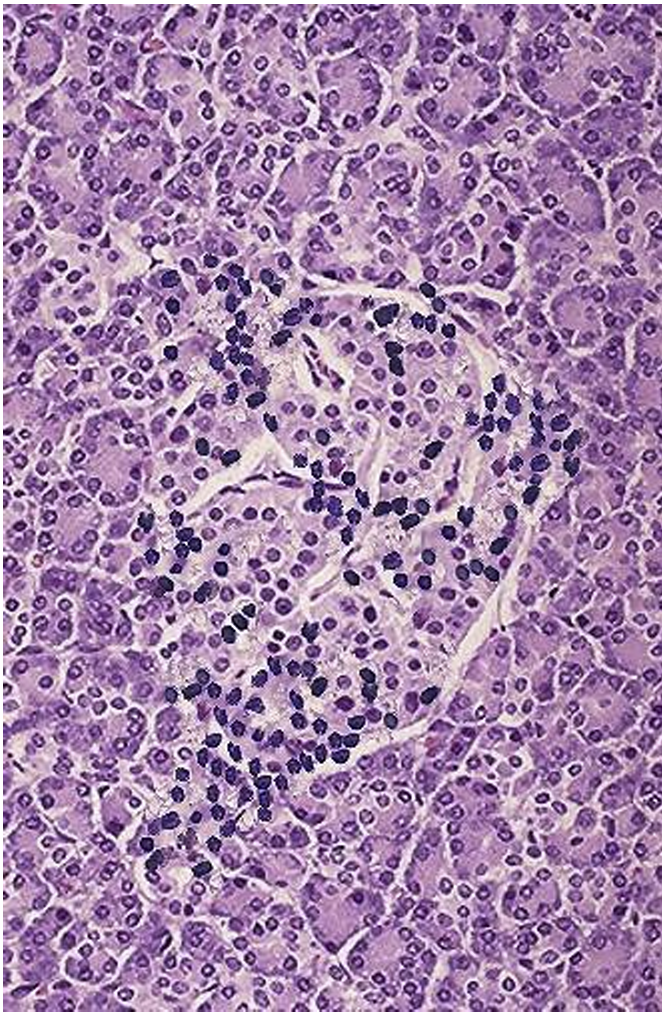 <p>What condition is this from what disease</p>