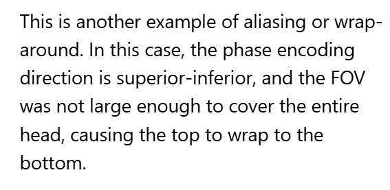 <p>D. Wraparound (aliasing)</p>