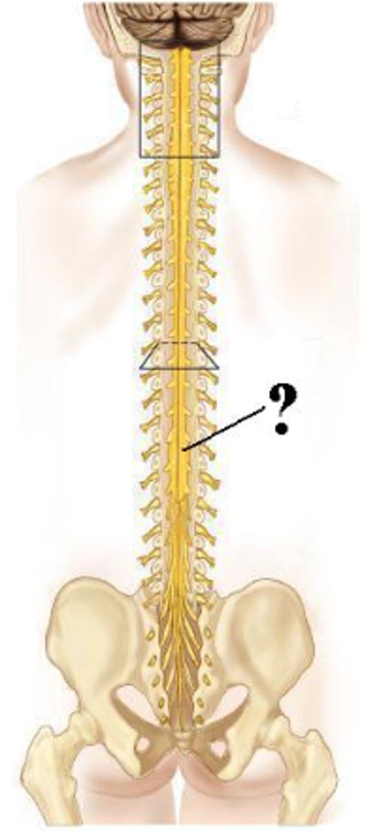 <p>lumbar enlargement</p>