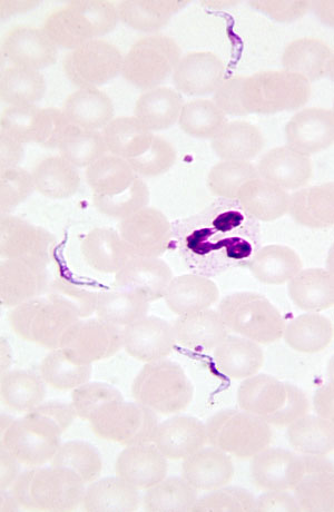 Trypanosoma brucei gambiense and trypanosoma brucei rhodesiense