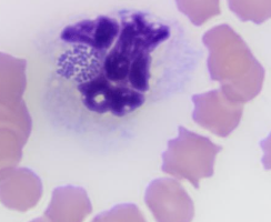 <p>-blood smear: morulae present in neutrophils 3-5 days after onset of fever</p><p>-PCR: buffy coat from EDTA sample (most sensitive, faster)</p><p>-serology: 4-fold increase in IFA titer in paired samples</p>