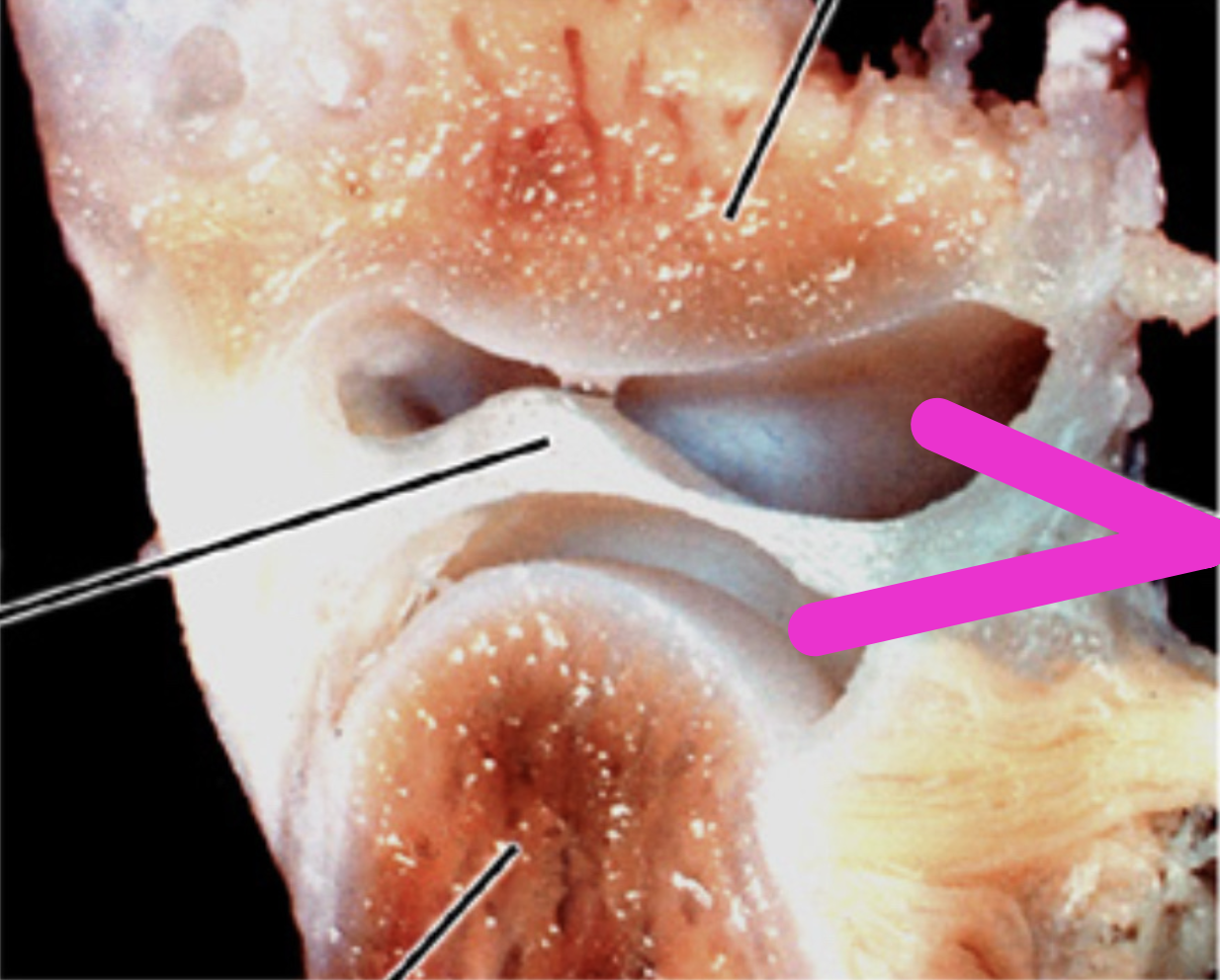 <p>Identify the structure</p>