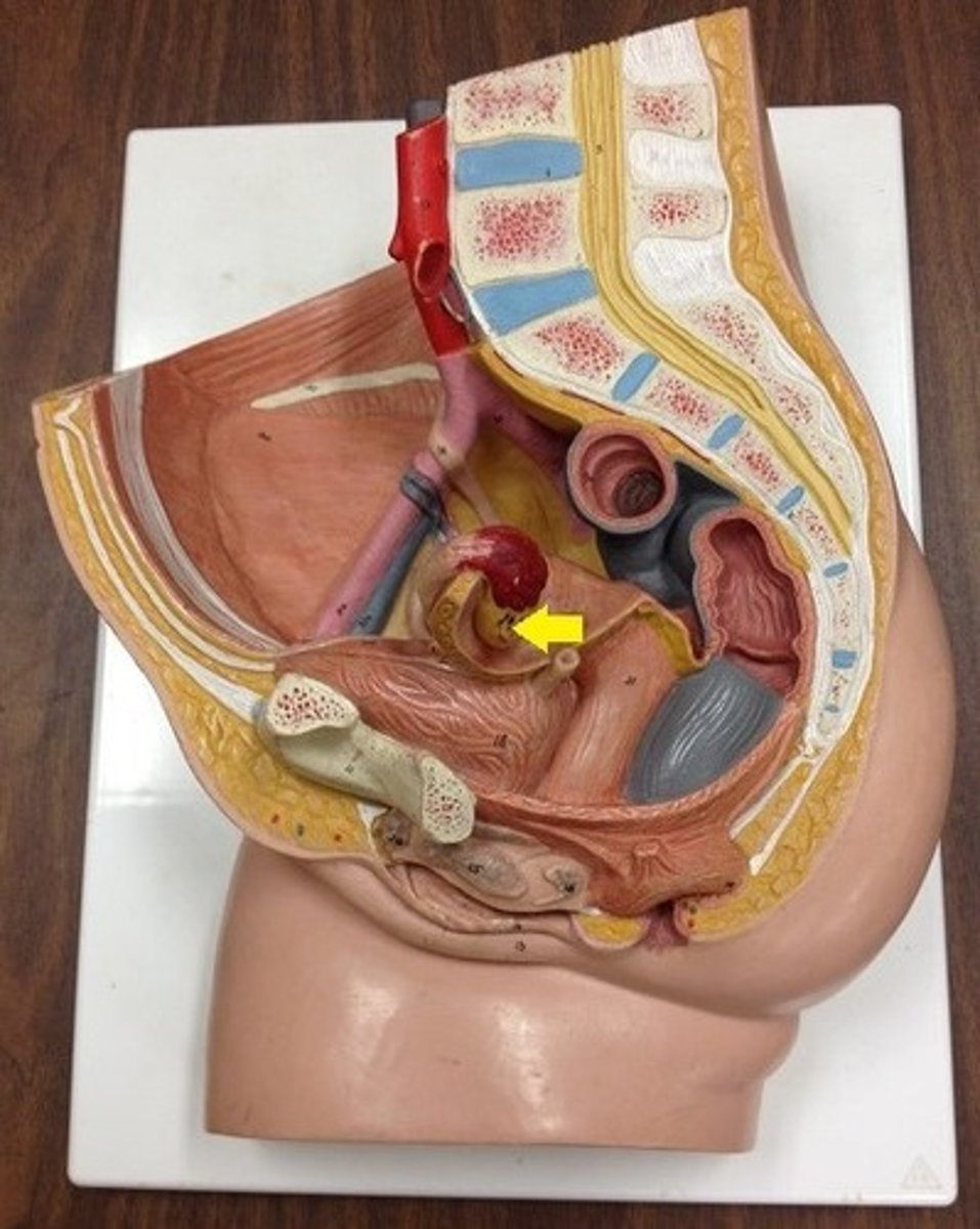 <p>Identify the organ.</p>