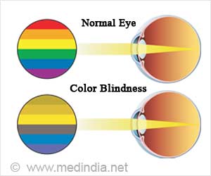 lack of one or more cone pigments (red, green, or blue)

most common: red-green