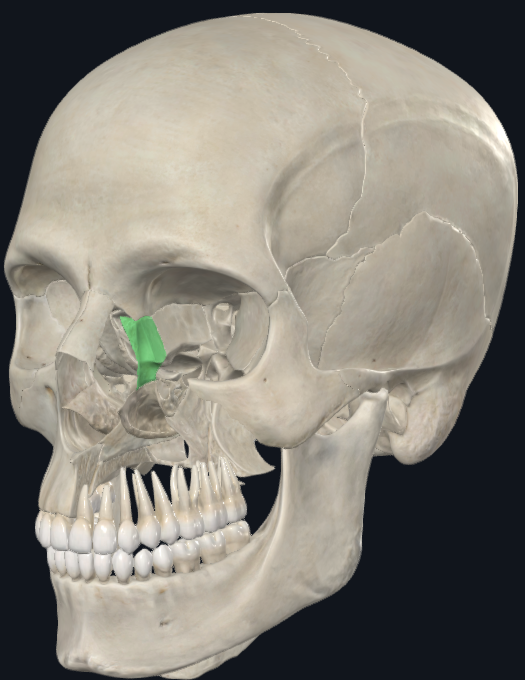 term image