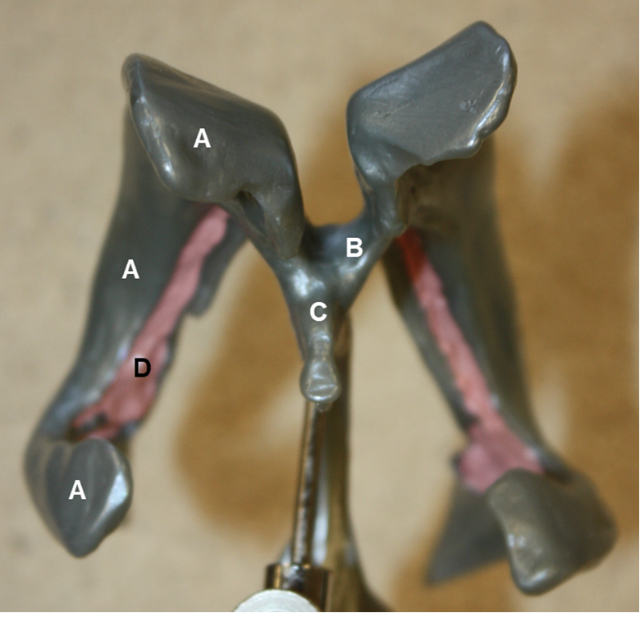 <p><span><span>In the image above (ventricular system), identify hollow structures A-C, and pink structure D.</span></span></p>
