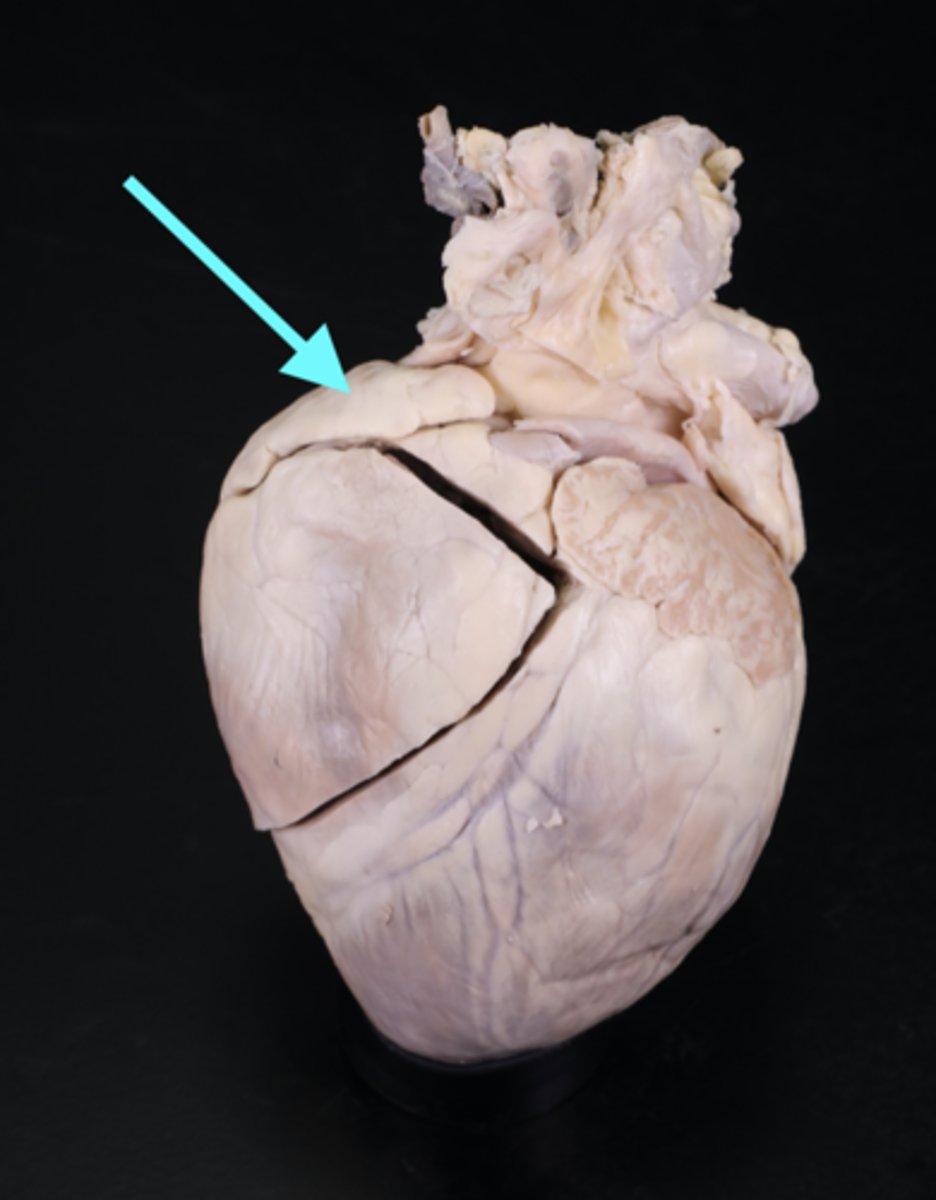 <p>top angle on right side</p>