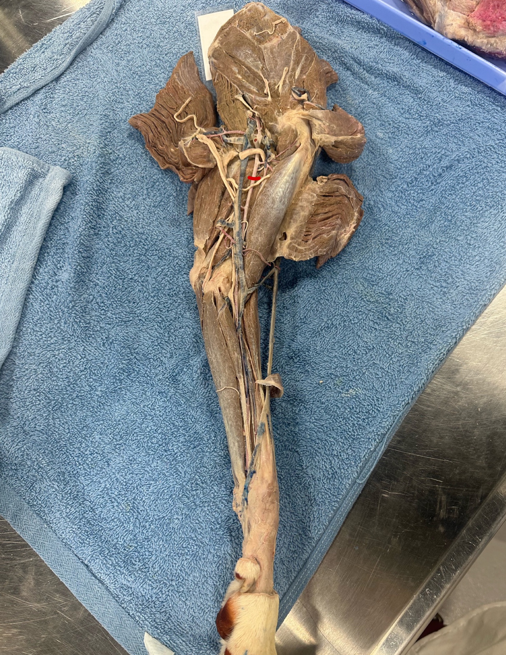<p>When working through your dissection you accidentally cut the label artery</p><ul><li><p>name this artery</p></li><li><p>What tissue/ region will not be supplied </p></li></ul><p></p>