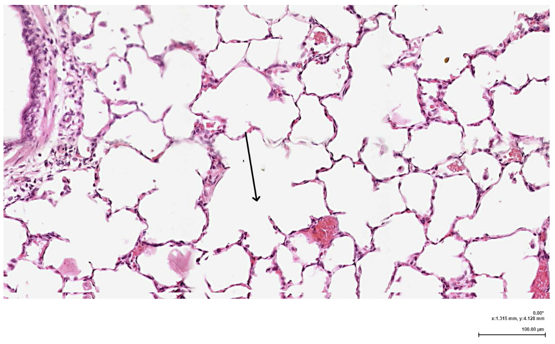 <p><span><span>The structure indicated by the arrow is most likely which of the following?</span></span></p>