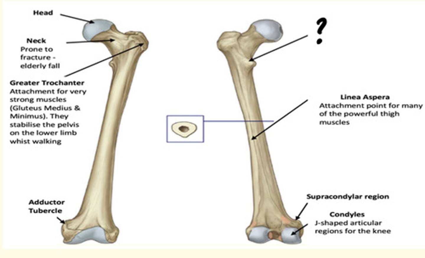 <p>Lesser Trochanter</p><p>Attachment for Iliopsoas - powerful hip flexor</p>
