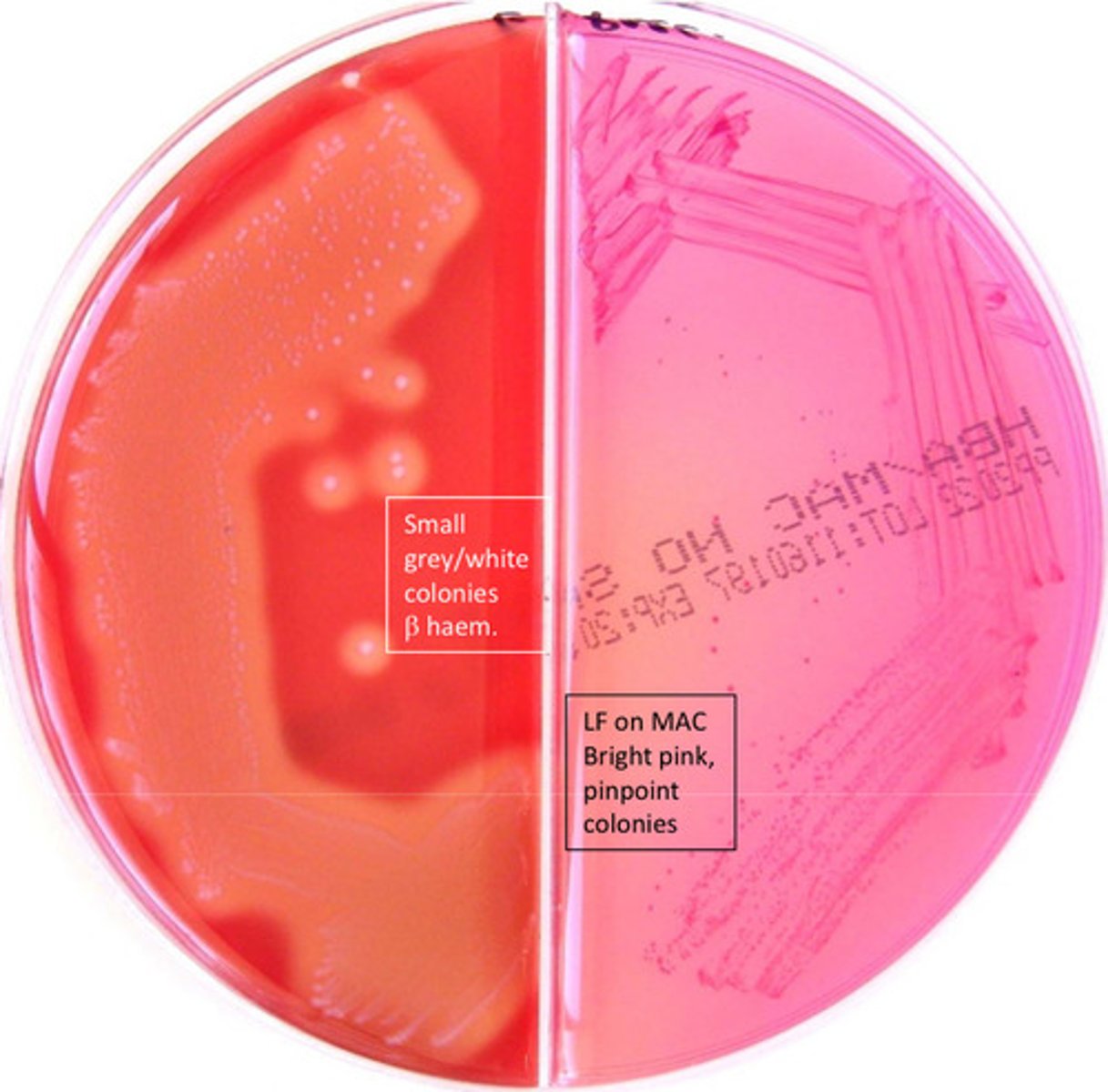 <p>cat neg GPC, lactose pos, PYR pos, Group D pos, mannitol pos, arabinose neg, salt tolerant, common cause of UTI, vancomycin resistant</p>