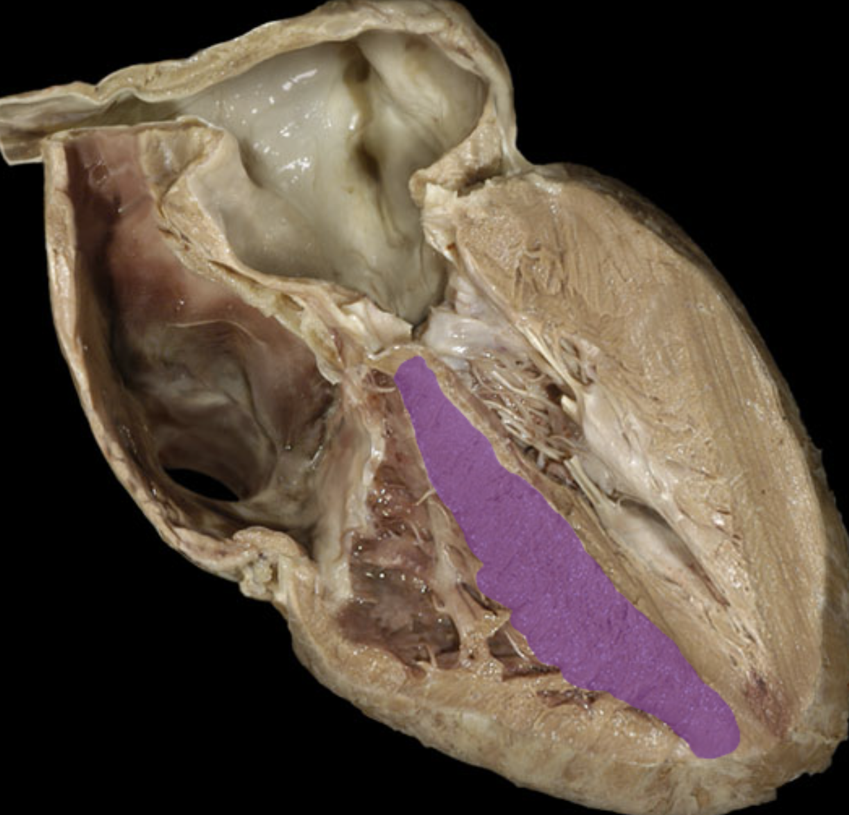 <p>Muscular interventricular septum</p>